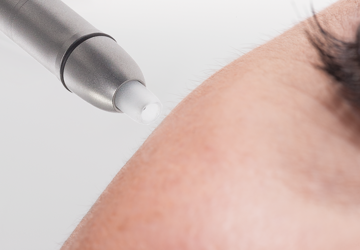 IONTO COMED Mikrodermabrasion