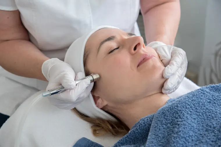 Microdermabrasion